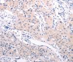 ABCF3 Antibody in Immunohistochemistry (Paraffin) (IHC (P))