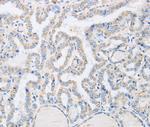 ABHD1 Antibody in Immunohistochemistry (Paraffin) (IHC (P))