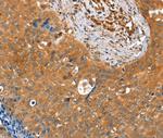 ACOT11 Antibody in Immunohistochemistry (Paraffin) (IHC (P))