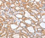 ACSBG1 Antibody in Immunohistochemistry (Paraffin) (IHC (P))