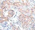 ACSM5 Antibody in Immunohistochemistry (Paraffin) (IHC (P))