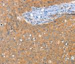 ACY3 Antibody in Immunohistochemistry (Paraffin) (IHC (P))