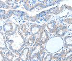 ADAM21 Antibody in Immunohistochemistry (Paraffin) (IHC (P))