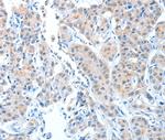 ADAMTSL1 Antibody in Immunohistochemistry (Paraffin) (IHC (P))