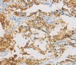 IDH3B Antibody in Immunohistochemistry (Paraffin) (IHC (P))