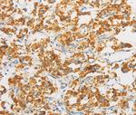 IDH3B Antibody in Immunohistochemistry (Paraffin) (IHC (P))