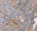 GMFG Antibody in Immunohistochemistry (Paraffin) (IHC (P))