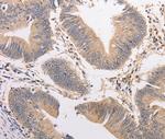 PIP5K1A Antibody in Immunohistochemistry (Paraffin) (IHC (P))