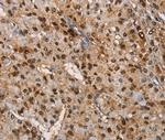 TSPEAR Antibody in Immunohistochemistry (Paraffin) (IHC (P))