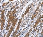 NCAPD3 Antibody in Immunohistochemistry (Paraffin) (IHC (P))