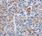 CENPJ Antibody in Immunohistochemistry (Paraffin) (IHC (P))