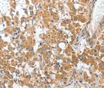 CHMP4B Antibody in Immunohistochemistry (Paraffin) (IHC (P))