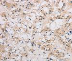 DDIT4L Antibody in Immunohistochemistry (Paraffin) (IHC (P))