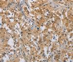 DDX43 Antibody in Immunohistochemistry (Paraffin) (IHC (P))