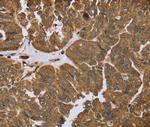 IKBIP Antibody in Immunohistochemistry (Paraffin) (IHC (P))