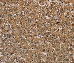 IKBIP Antibody in Immunohistochemistry (Paraffin) (IHC (P))