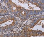 LIMS1 Antibody in Immunohistochemistry (Paraffin) (IHC (P))