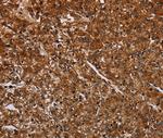 ACP6 Antibody in Immunohistochemistry (Paraffin) (IHC (P))