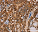 MBNL3 Antibody in Immunohistochemistry (Paraffin) (IHC (P))