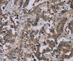 Nectin 4 Antibody in Immunohistochemistry (Paraffin) (IHC (P))