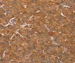 PAGE5 Antibody in Immunohistochemistry (Paraffin) (IHC (P))