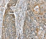 PHLPP1 Antibody in Immunohistochemistry (Paraffin) (IHC (P))