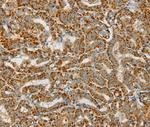 PDP1 Antibody in Immunohistochemistry (Paraffin) (IHC (P))