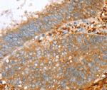 PTPN7 Antibody in Immunohistochemistry (Paraffin) (IHC (P))