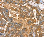 PYGL Antibody in Immunohistochemistry (Paraffin) (IHC (P))