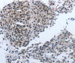 NPR1 Antibody in Immunohistochemistry (Paraffin) (IHC (P))