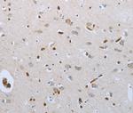 FGF1 Antibody in Immunohistochemistry (Paraffin) (IHC (P))