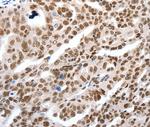 LIFR Antibody in Immunohistochemistry (Paraffin) (IHC (P))