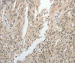 TOP1MT Antibody in Immunohistochemistry (Paraffin) (IHC (P))