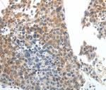 ABCG5 Antibody in Immunohistochemistry (Paraffin) (IHC (P))