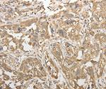 ADHFE1 Antibody in Immunohistochemistry (Paraffin) (IHC (P))