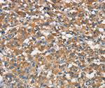 APOA1BP Antibody in Immunohistochemistry (Paraffin) (IHC (P))