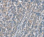 ACPT Antibody in Immunohistochemistry (Paraffin) (IHC (P))