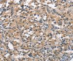 ACPT Antibody in Immunohistochemistry (Paraffin) (IHC (P))