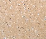 TACR2 Antibody in Immunohistochemistry (Paraffin) (IHC (P))