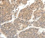 SLC27A1 Antibody in Immunohistochemistry (Paraffin) (IHC (P))