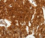 TENM3 Antibody in Immunohistochemistry (Paraffin) (IHC (P))