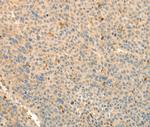 TMSB4X Antibody in Immunohistochemistry (Paraffin) (IHC (P))