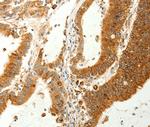 RARRES1 Antibody in Immunohistochemistry (Paraffin) (IHC (P))