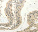 FZD8 Antibody in Immunohistochemistry (Paraffin) (IHC (P))