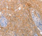 ABCA2 Antibody in Immunohistochemistry (Paraffin) (IHC (P))