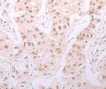 ADAM12 Antibody in Immunohistochemistry (Paraffin) (IHC (P))