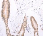 ADAM12 Antibody in Immunohistochemistry (Paraffin) (IHC (P))