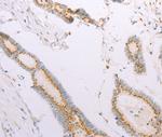 ADAM28 Antibody in Immunohistochemistry (Paraffin) (IHC (P))