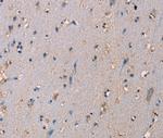 ADAM29 Antibody in Immunohistochemistry (Paraffin) (IHC (P))