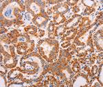 ADAMTS17 Antibody in Immunohistochemistry (Paraffin) (IHC (P))